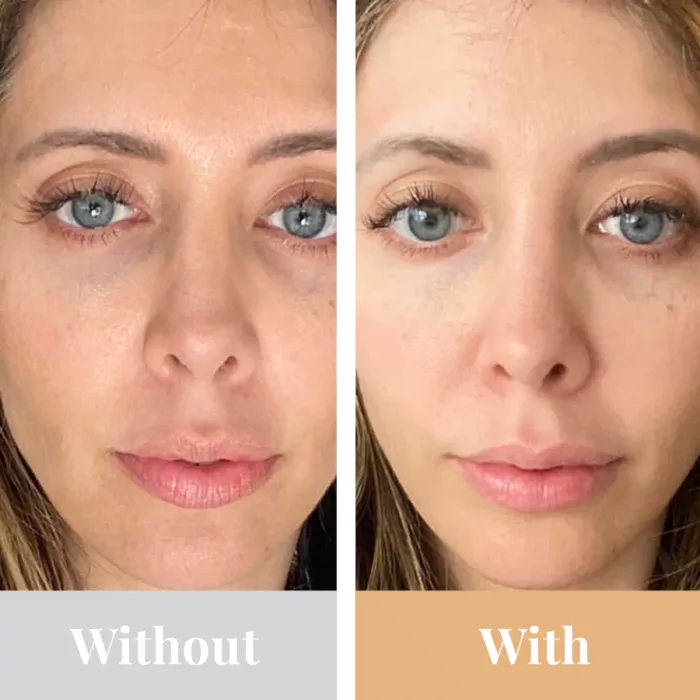 Omnilux Face Contour Mask with and without